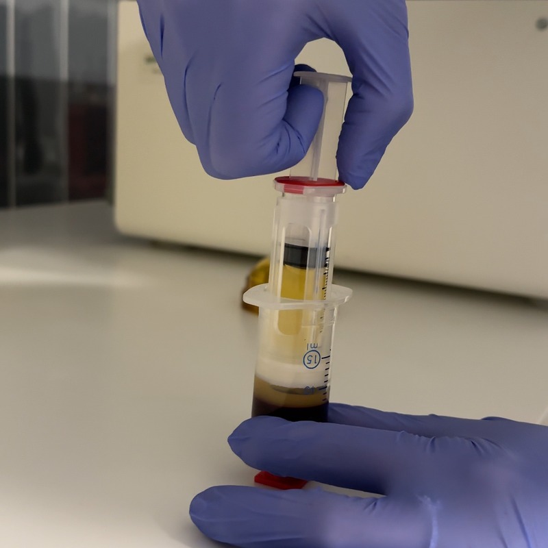 Manipulación de la jeringa para obtener el plasma rico en plaquetas.